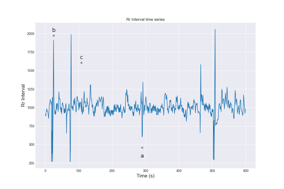 ectopic_corr_RR_signal_2
